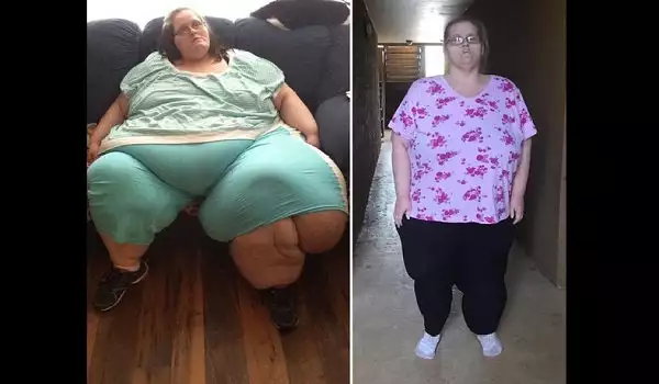 Преди и сега: Вижте преобразяването на 300-килограмови хора