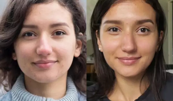 След 4 години веганство тя прояде месо! Вижте как се промени лицето ѝ