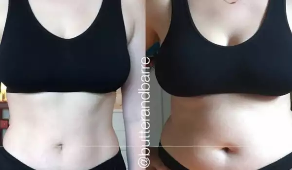 Вижте невероятната трансформация на хора преди и след кетонната диета