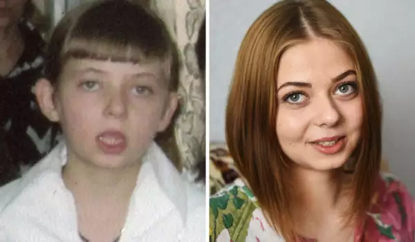 Снимките на деца преди и след осиновяване ще стоплят сърцето ви