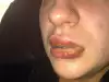Тя си купи евтино червило и едва не умря! Вижте историята ѝ